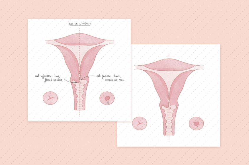 col-uterus-fertile-infertile