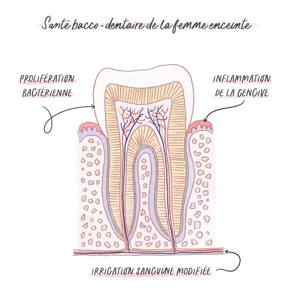 Illustration de la santé bucco-dentaire de la femme enceinte